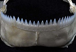Untere Zähne