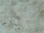 Hyfen Rhizoctonia solani