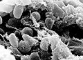 Yersinia pestis (γ)