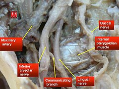 Mandibular nerve 1.jpg