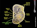 Coracobrachialis muscle (shown in green text). Horizontal section of arm.