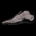 CT 3D snimak kože i kostiju ljudskog stopala