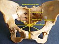 Diameters of pelvic inlet