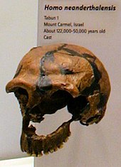 A skull missing most of the left side of the face from the mid-orbit to the teeth