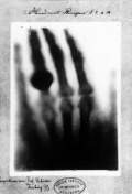 Вильгельм Рентген. «Рука с кольцами», Вюрцбургский университет, 22 декабря 1895 года