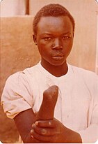 shown is Idris Al-Nur Koko, a young Sudanese wearing a white jalabiya, a traditional Sudanese garment. Koko is standing in front of a plain, textured wall with a calm but serious expression. Koko’s left arm is amputated just below the elbow, which they hold gently with their right hand.