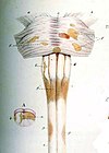 Jedna od prvih anatomskih ilustracija multiple skleroze, 1838.