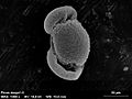 マツ属の花粉の電子顕微鏡写真 Pinus mugo