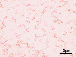Shigella flexneri у мікропрепараті при світловій мікроскопії — червоні Грам-негативні бактерії.