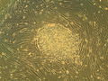 Thumbnail for Embryonic stem cell