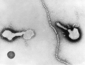 파라인플루엔자바이러스의 투과전자현미경 사진. 두 개의 바이러스 입자와 섬유성 캡시드가 자유롭게 떠다니고 있다.