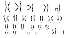 El cromosoma X extra se produce por una alteración biológica, pero involucra características específicas propias la patología, tanto anatómicas como psicoafectivas y sociales. Un cromosoma X extra altera la adecuada conformación de gametas necesarias para formar los espermatozoides.