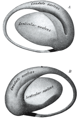 Twee aanzichten van het corpus striatum, gezien vanaf de buiten- (bovenste beeld) en binnenkant (onderste beeld) van de hersenen. De nucleus lentiformis is gelabeld "lenticular nucleus".