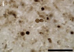 Spheroidal microfossils - Gunflint Chert - 1.88 Ga.png