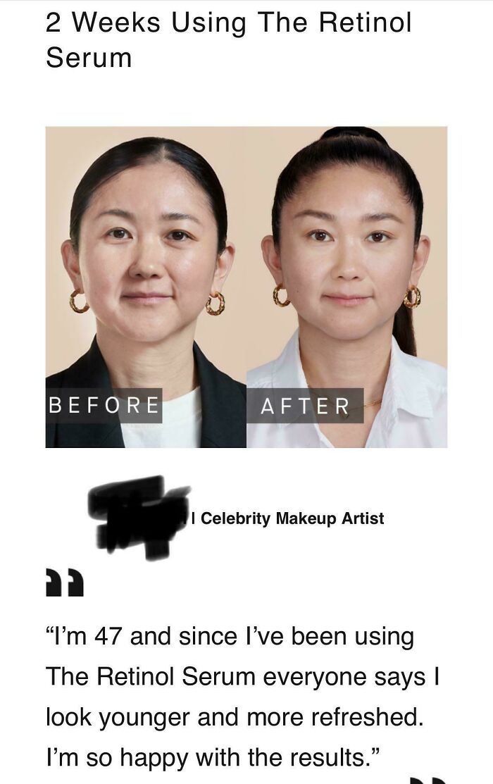 In A Newsletter From A High End Skincare Brand - 2 Weeks Usage 😅