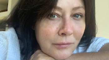 Shannen Doherty trata doença desde 2015 e anunciou, no final do ano passado, que enfermidade atingiu seus ossos