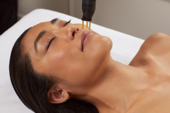 NeoGen PRS, a skin tightening and firming technique, at Ouronyx