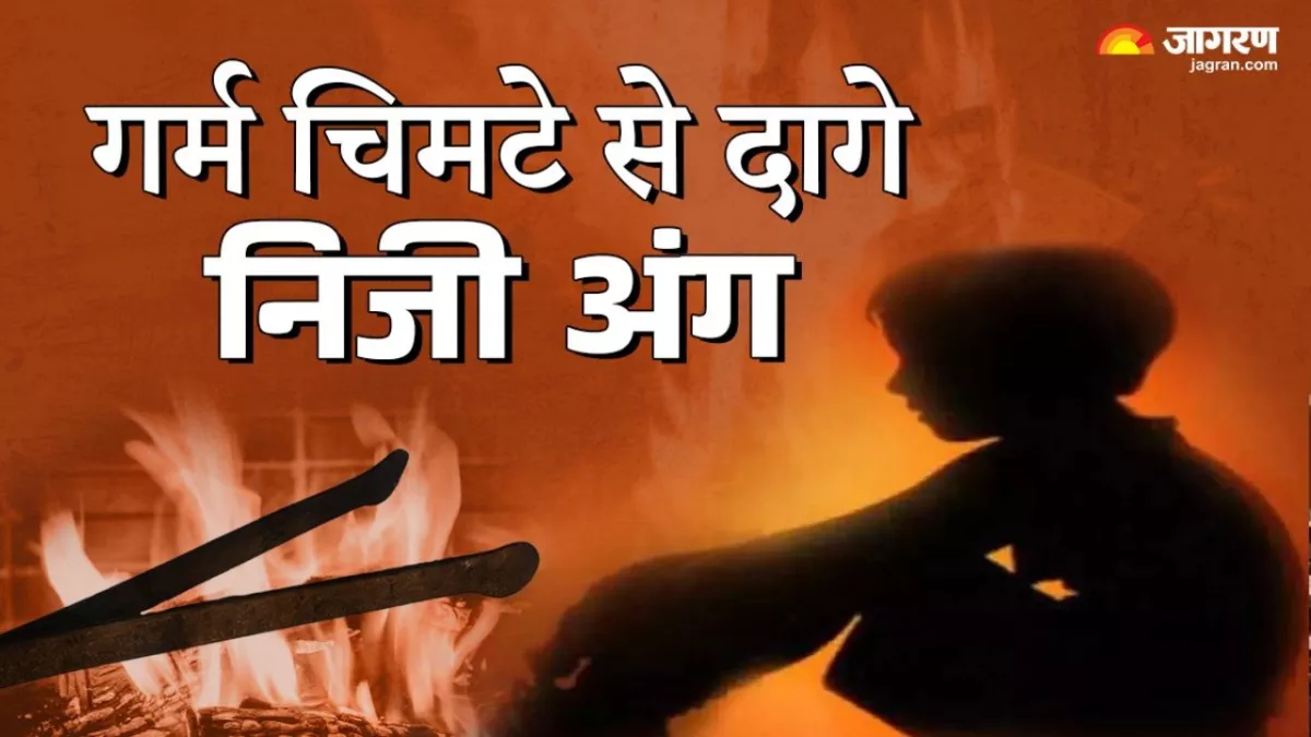 तू कैसी बुआ? गर्म चिमटे से मासूम के निजी अंग दागे, जिंदगी और मौत के बीच जूझ रही बच्ची; कसूर था सिर्फ इतना