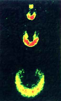  Repeated release from the trap of parts of a Bose-Einstein condensate of sodium atoms