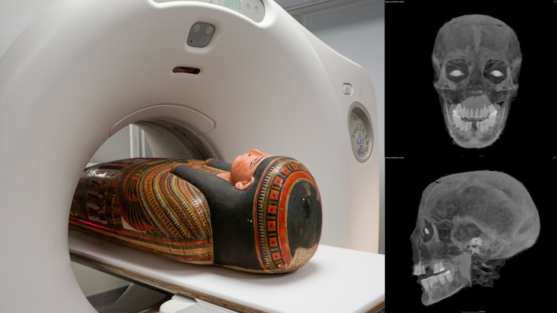 Side by side of mummy entering CT scanner with two images of a mummy's skull scan