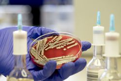 Escherichia coli (E. coli) colonies