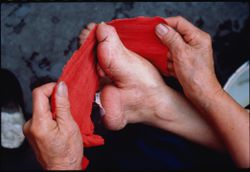 An elderly lady re-wraps her bound foot