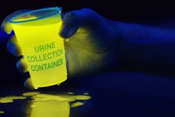 Urine glows when exposed to black or ultraviolet light.