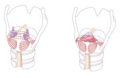 A rear-view illustration of the glottis, the space created by opening and closing the vocal chords: on the left, the vocal folds are open, and on the right, the vocal folds are closed